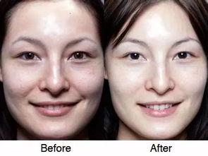 关于毁容的表情包,网络时代的幽默与讽刺