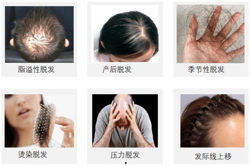 头发炸毛图片,展现个性与时尚的潮流风向标